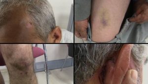 Gaziantep Barosu, Halfeti’deki işkenceyi belgeledi: Elektrik verme, haya sıkma ve….