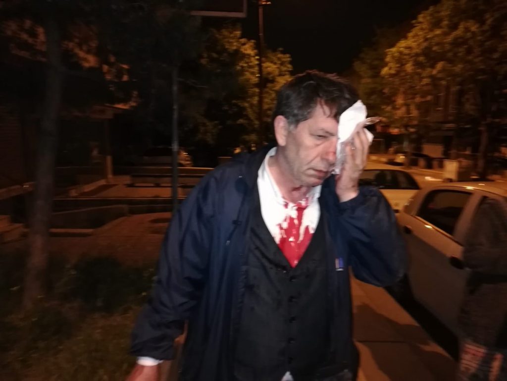 Türkiye’de gazeteciler hedefte: Bir yazar yoğun bakımda, 3 muhabir nezarette