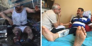 5 Haziran bombasının mağduru: Parçalanan bedenler rüyama geliyor