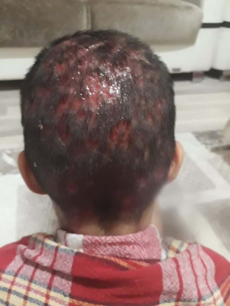 Küçük Lorin’in büyük dramı; Bana saçımı geri verin…