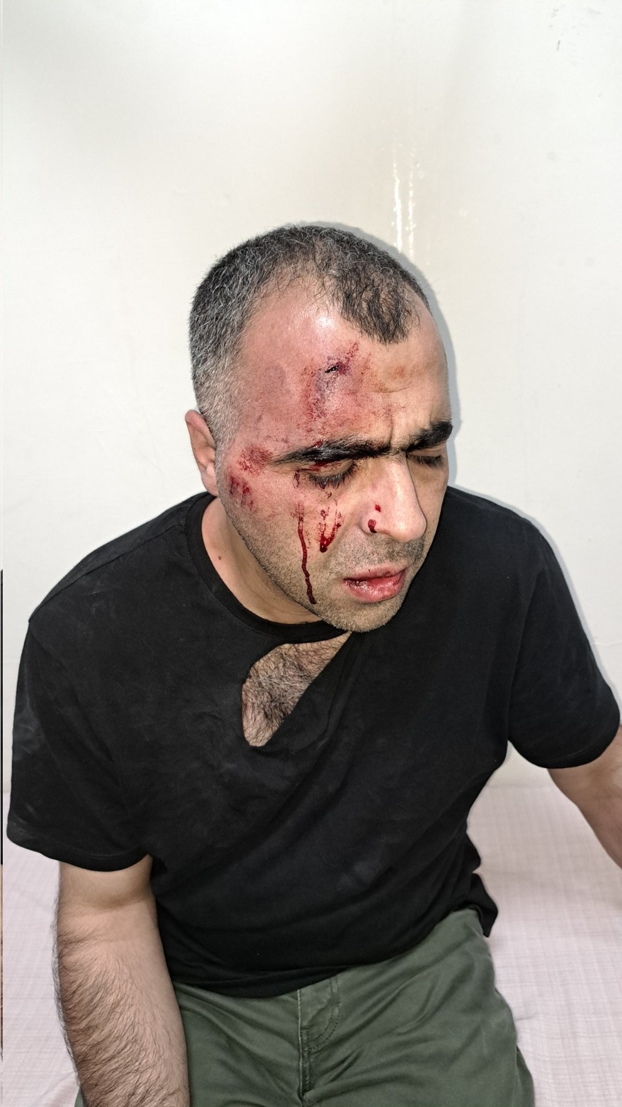 Gazeteci Sinan Aygül’e saldıran 2 kişi tutuklandı