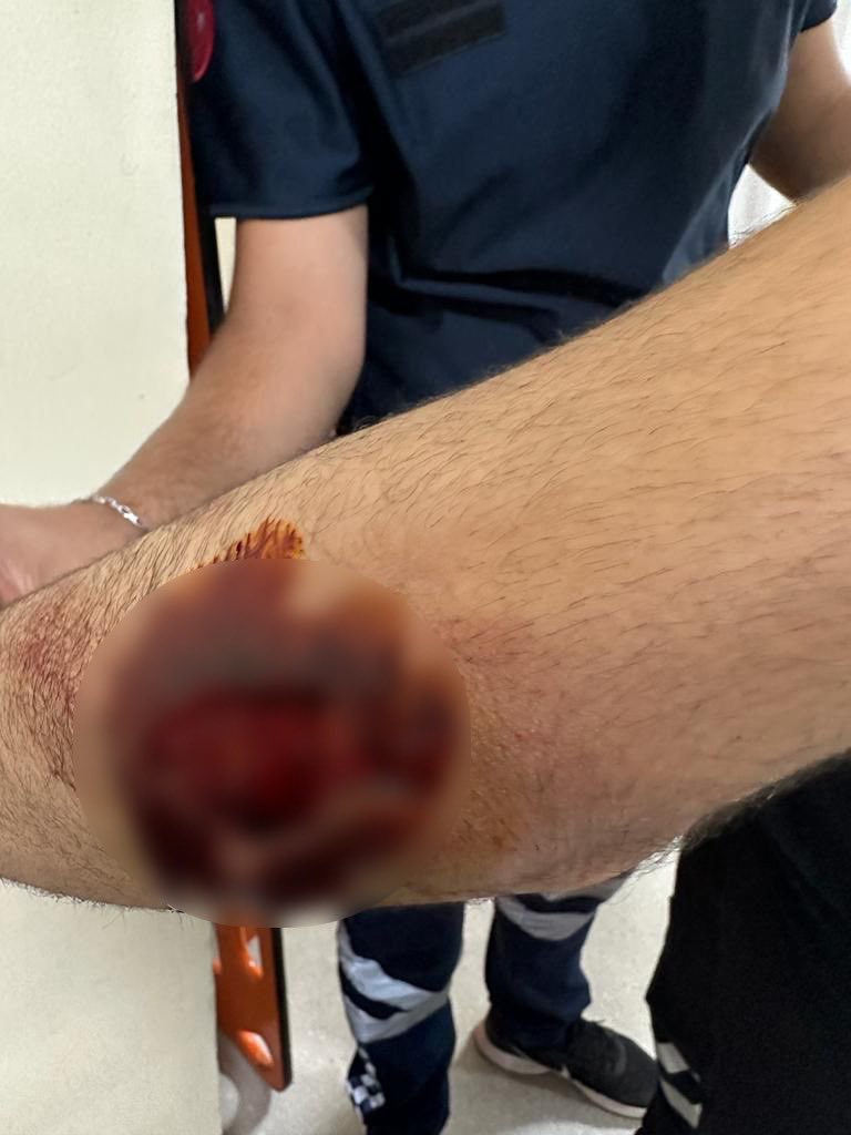 Diyarbakır’da 4 sağlıkçı bıçaklandı