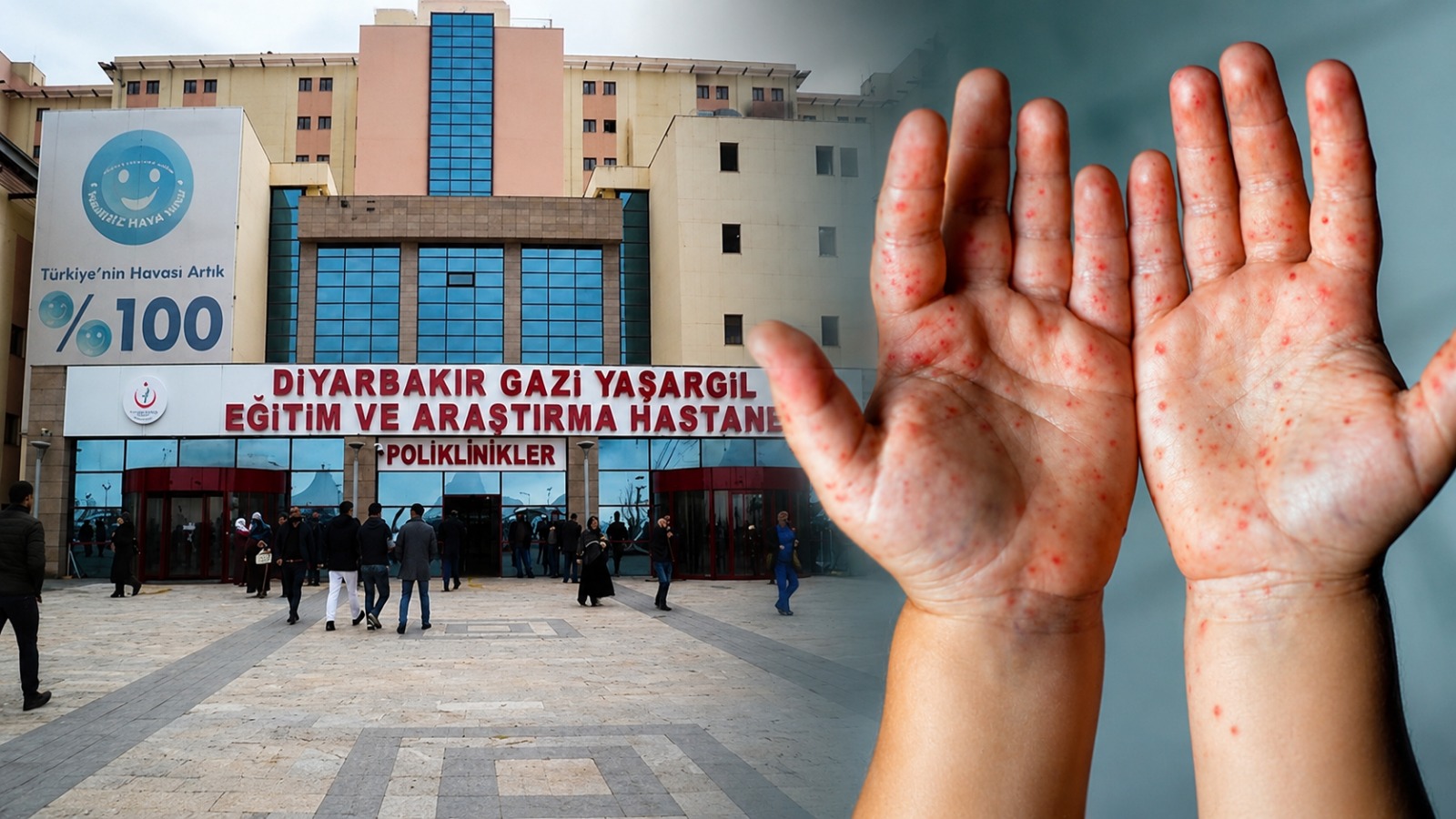Diyarbakır’da korkutan salgın: Hastanelerde yoğunluk arttı!